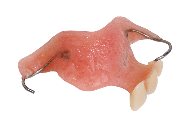 dental flipper
