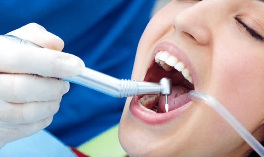 dental bonding