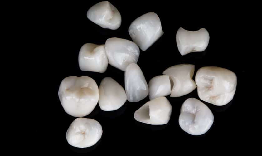 Dental Veeners Naperville - Living Well Dental Group - Dentist Naperville