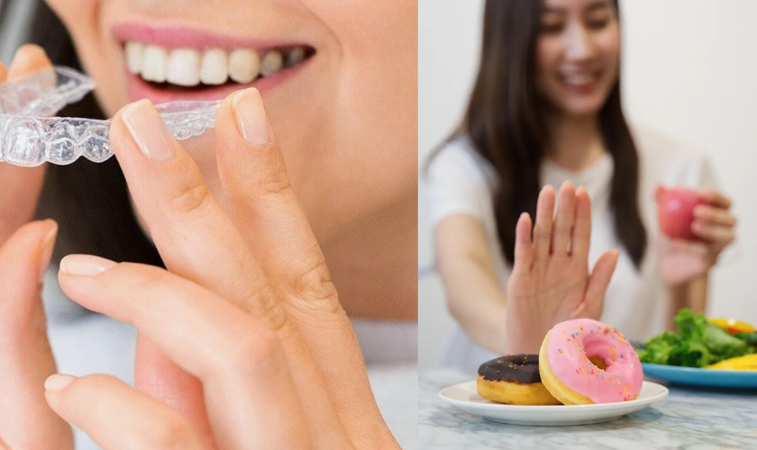 Drink Coffee Or Eat Anything Else With Invisalign