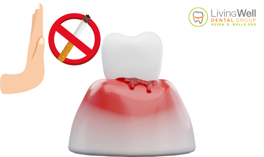 Smoking Lead to Gum Disease