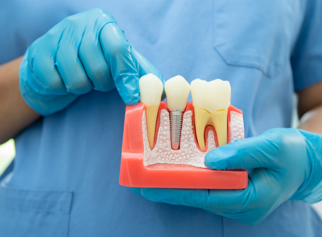 ready for dental implants top questions to ask your dentist