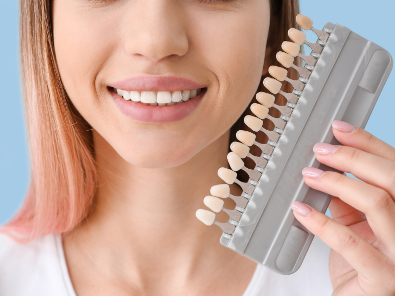 Veneers Replace Braces for Straight Teeth