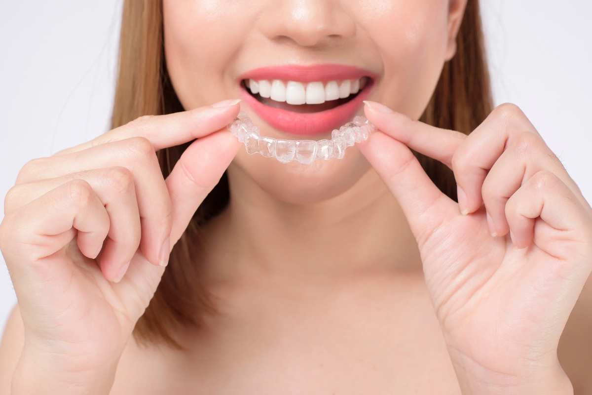 Invisalign-in-Naperville